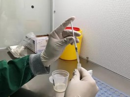 人工授精是如何洗滌男性精子的？求操作流程分享！